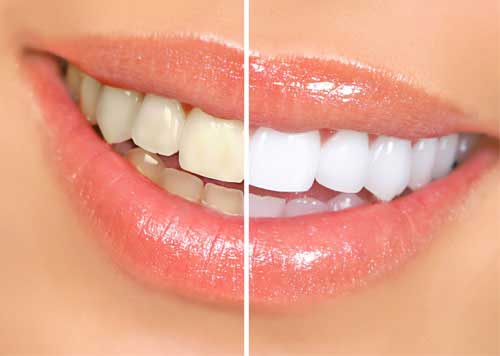 Dental 